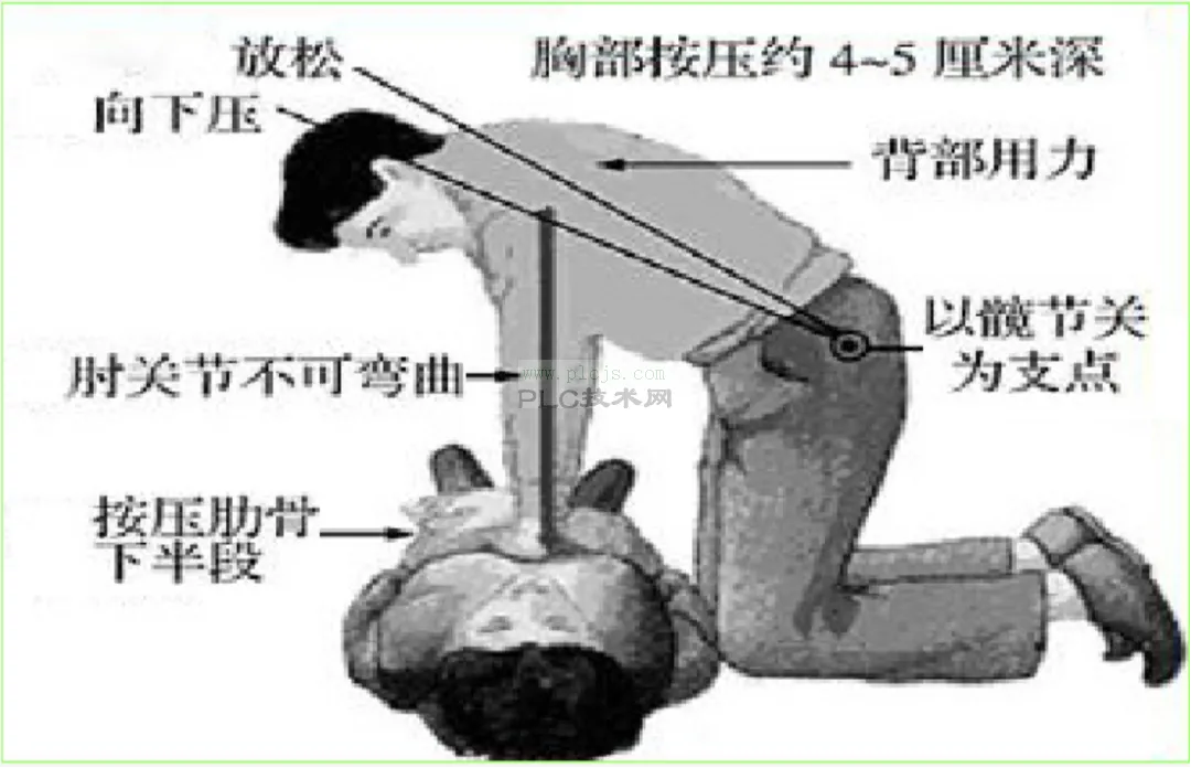 心肺复苏
