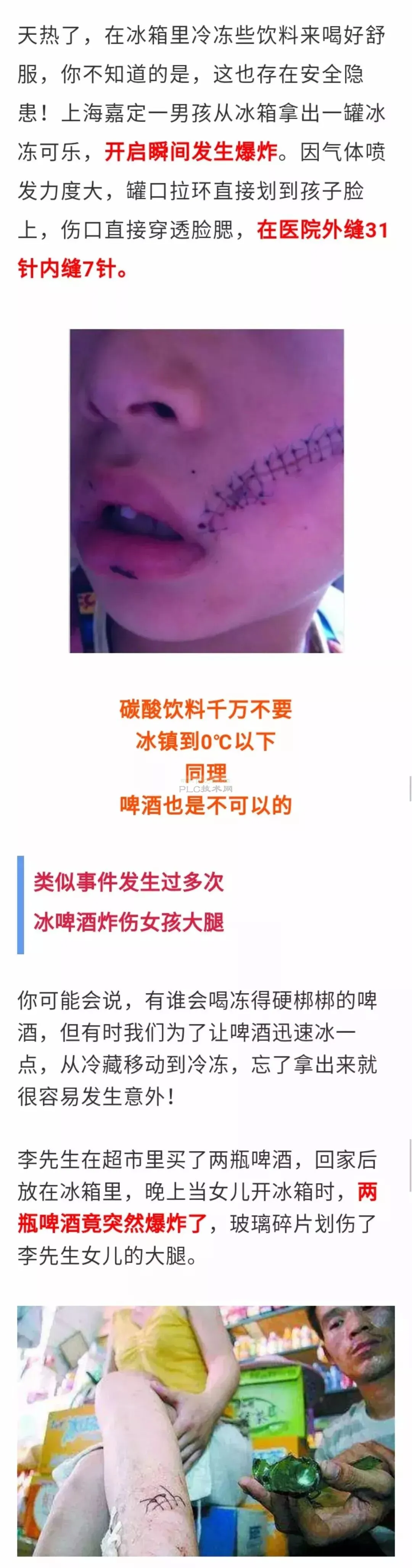 瞬间被炸，脸缝38针！夏天把它放冰箱等于炸弹！实用。
